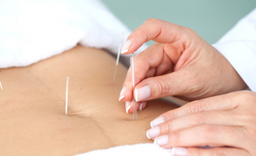 acupuncture-minceur