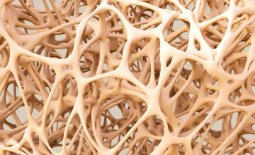Les remèdes naturels contre l'ostéoporose